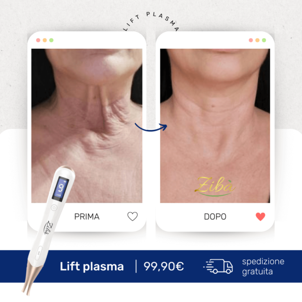 Lift Plasma risultati prima e dopo sul collo